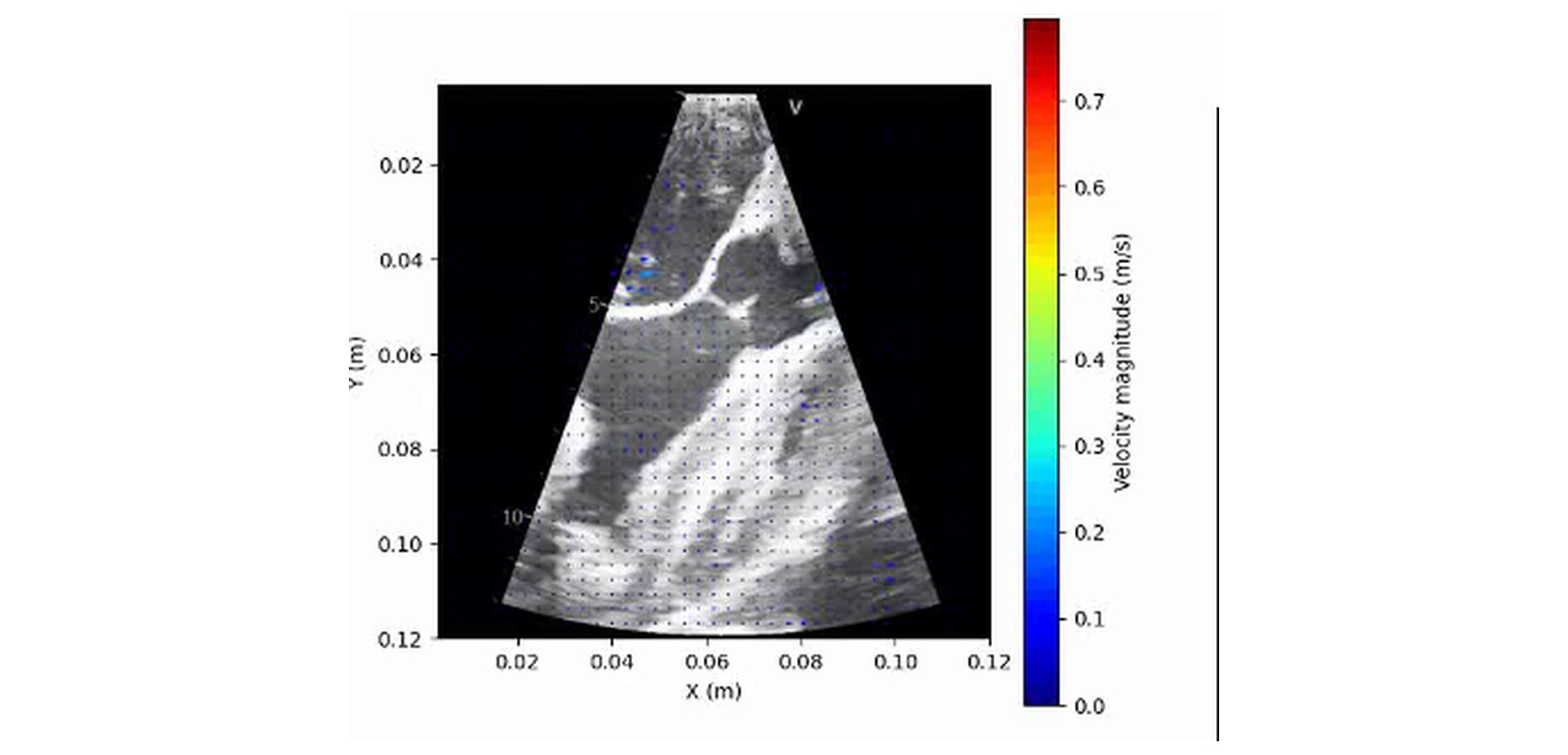 Ultrasound and simulated cardiac flow fields